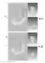 Fig. 08 - ORTHOPEDIC IMPLANT AND METHOD OF MAKING SAME