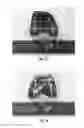 Fig. 09 - ORTHOPEDIC IMPLANT AND METHOD OF MAKING SAME