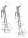 Fig. 05 - Implantable prosthesis for replacing a human hip or knee joint and the adjoining bone sections