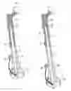 Fig. 06 - Implantable prosthesis for replacing a human hip or knee joint and the adjoining bone sections