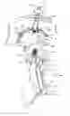 Fig. 01 - SOCKET AND PROSTHESIS FOR JOINT REPLACEMENT