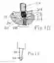 Fig. 03 - SOCKET AND PROSTHESIS FOR JOINT REPLACEMENT