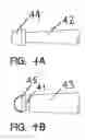 Fig. 06 - SOCKET AND PROSTHESIS FOR JOINT REPLACEMENT