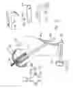 Fig. 09 - SOCKET AND PROSTHESIS FOR JOINT REPLACEMENT