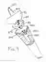 Fig. 11 - SOCKET AND PROSTHESIS FOR JOINT REPLACEMENT