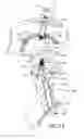 Fig. 16 - SOCKET AND PROSTHESIS FOR JOINT REPLACEMENT