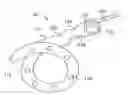 Fig. 01 - UROLOGICAL MEDICAL DEVICES