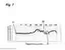Fig. 08 - BLOOD SUGAR VALUE ESTIMATION APPARATUS