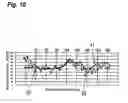 Fig. 11 - BLOOD SUGAR VALUE ESTIMATION APPARATUS