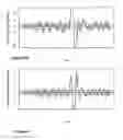 Fig. 07 - CHROMATOGRAPHIC PEAK IDENTIFICATION USING BOOTSTRAP REPLICATION OBJECT ORIENTED SYSTEM AND METHOD