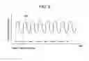Fig. 06 - Electronic device, pedometer, and program