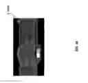 Fig. 11 - SYSTEM AND GRAPHICAL USER INTERFACE FOR MONITORING AND DISPLAYING RADIOLOGY IMAGE TRAFFIC