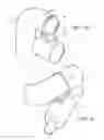 Fig. 07 - ANTI-ROTATION DEVICES AND SYSTEMS
