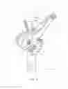 Fig. 07 - Cable control set for extended reach garden shears