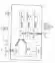 Fig. 04 - Spray dried human plasma