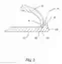 Fig. 04 - Trap with improved rodent retention characteristics