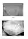 Fig. 07 - Surface etched diamond particles and method for etching the surface of diamond particles
