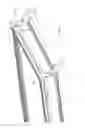 Fig. 07 - Window system having flexible means for mounting
