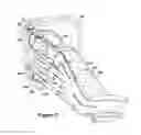 Fig. 06 - Methods, systems and apparatus for detecting material defects in combustors of combustion turbine engines