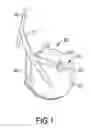 Fig. 02 - Key cup adjustment device for a wind instrument
