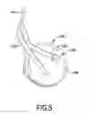 Fig. 05 - Key cup adjustment device for a wind instrument