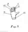 Fig. 05 - Method and Device for Playing of Musical Melodies
