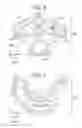 Fig. 07 - Cylinder block