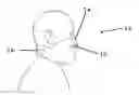 Fig. 01 - ADJUSTABLE FACIAL CONFORMING FACE MASK
