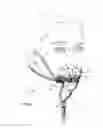 Fig. 05 - Apparatus for positioning a nasal cannula