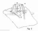 Fig. 04 - Surgical drape