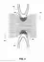 Fig. 06 - Multi-edge dental floss