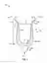Fig. 04 - Flossing devices and methods of using same
