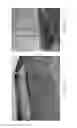 Fig. 05 - MOBILE DISASTER CHATTEL RESTORATION UNIT