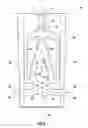 Fig. 09 - CONICAL FLUIDIC OSCILLATOR INSERTS FOR USE WITH A SUBTERRANEAN WELL