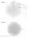 Fig. 10 - Method and apparatus for forming a thin lamina