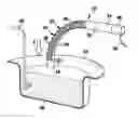 Fig. 01 - Surgical needle and method of manufacturing a surgical needle