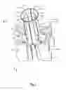Fig. 03 - Drill rod guide