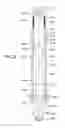 Fig. 33 - Apparatus and methods for drilling a wellbore using casing