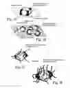 Fig. 26 - Electrochemical sensors