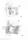 Fig. 05 - Switchgear device having at least one single-pole breaking unit comprising a contact bridge and circuit breaker comprising one such device