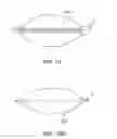 Fig. 10 - Intraocular, accommodating lens and methods of use