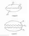 Fig. 13 - Intraocular, accommodating lens and methods of use