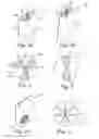 Fig. 04 - VALVE HAVING AN ABLATED FLAP