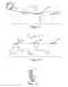 Fig. 05 - VALVE HAVING AN ABLATED FLAP