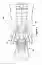 Fig. 02 - METHODS, SYSTEMS AND APPARATUS FOR DETECTING MATERIAL DEFECTS IN COMBUSTORS OF COMBUSTION TURBINE ENGINES