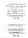 Fig. 06 - MR IMAGING SYSTEM WITH FREELY ACCESSIBLE EXAMINATION VOLUME