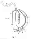 Fig. 06 - Wireless control of laryngoscope system