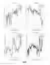 Fig. 02 - Drowsy driver detection system