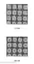 Fig. 18 - MICROELECTROMECHANICAL DEVICE WITH THERMAL EXPANSION BALANCING LAYER OR STIFFENING LAYER