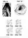 Fig. 06 - Downhole optical imaging tools and methods